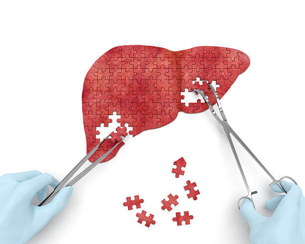 Liver Surgery